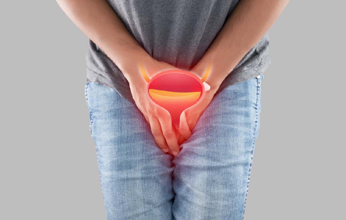 ../Image/bladder-cancer2.jpeg