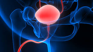 ../Image/bladder-cancer1