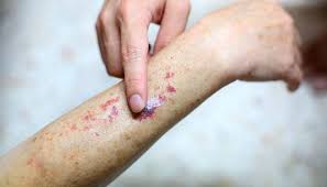 ../Image/blood-cancer2.jpeg