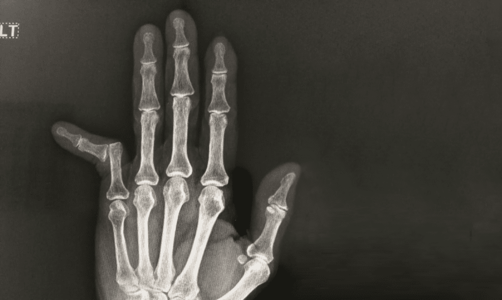 ../Image/dislocation2.jpeg