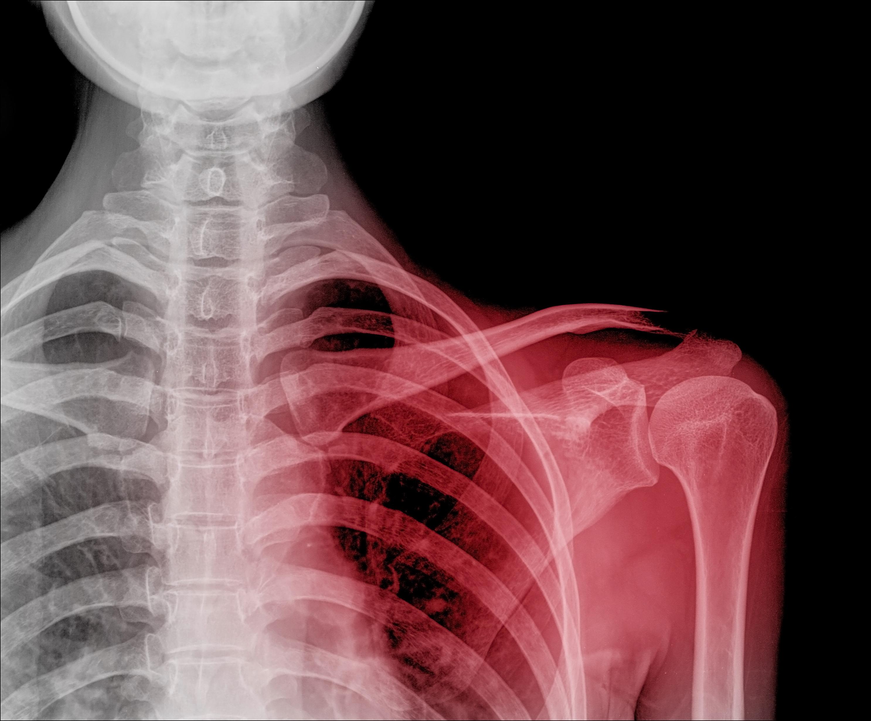../Image/dislocation3.jpeg