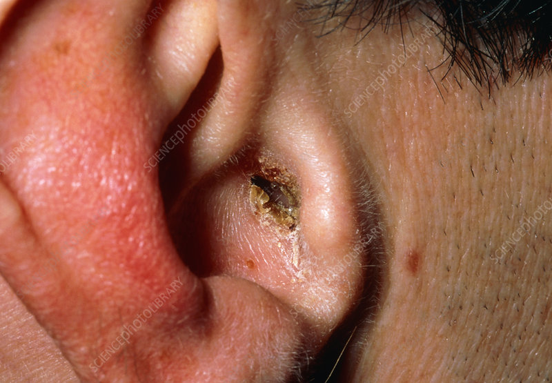 ../Image/ear2.jpeg