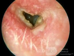 ../Image/ear3.jpeg