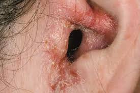 ../Image/ear4.jpeg