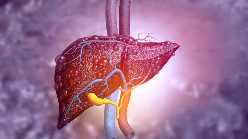../Image/liver-cancer4.jpeg