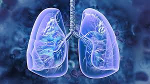 ../Image/lung-cancer2.jpeg