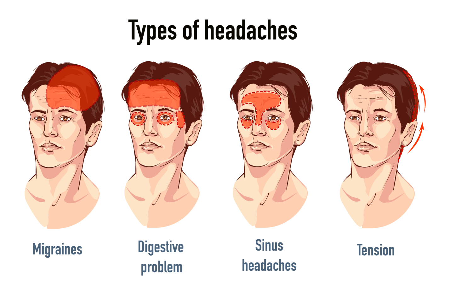 ../Image2/headache3.jpeg
