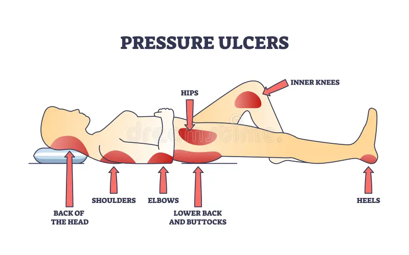 ../Image2/pressure3.jpeg