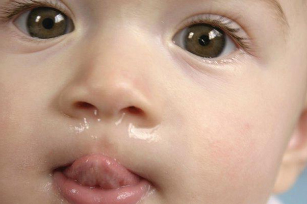 ../Image2/runnynose2.jpeg