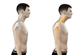 Text neck img